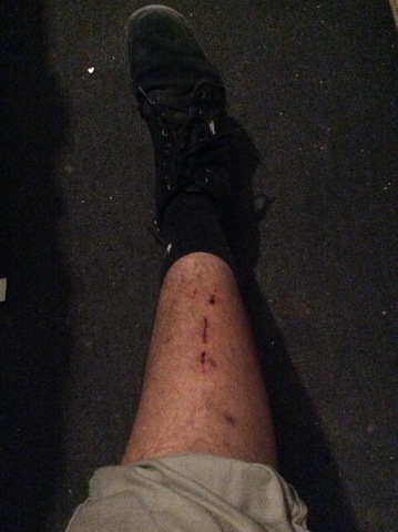 Aprendi hacer Crank Flip en la bmx