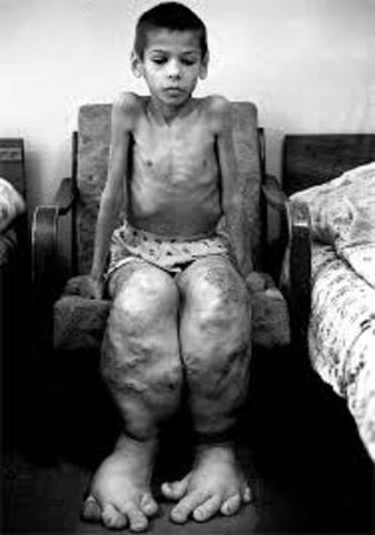 DESASTRE NUCLEAR EN CHERNOBYL