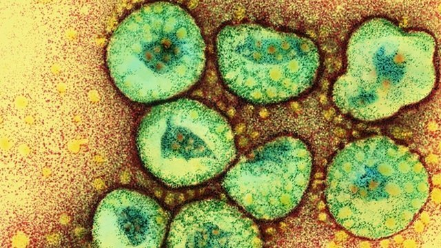 Sars virus