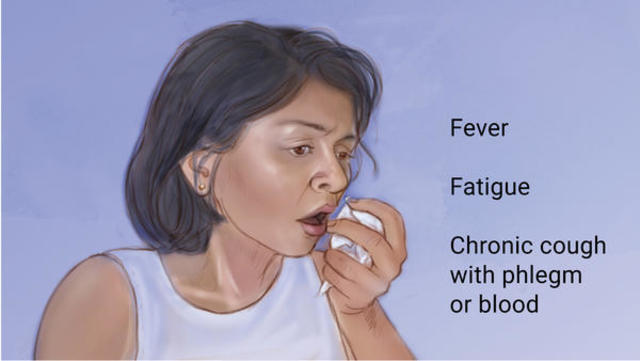 adopted mother turborculois