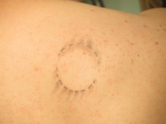 Expulsion de guarderia (?)