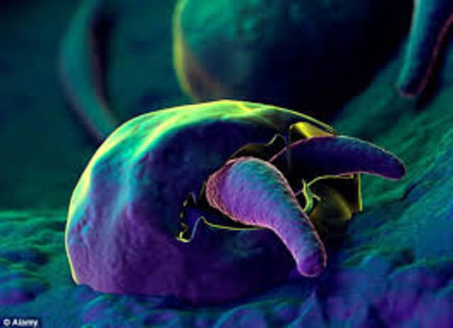 Cryptosporidium Outbreak in Milwaukee