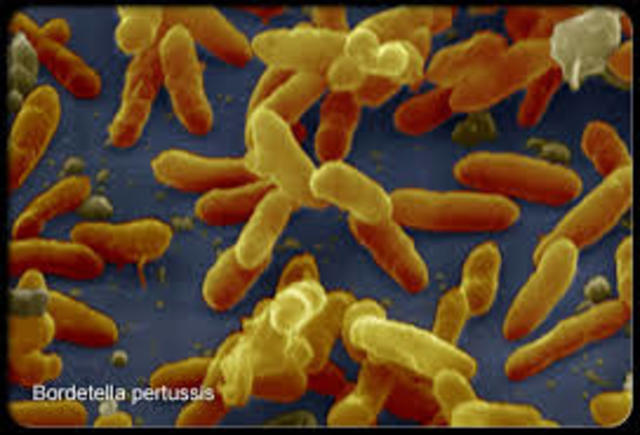 Whooping Cough in California