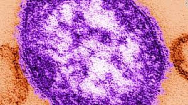measles outbreak