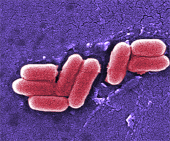 E Coli O157:H7