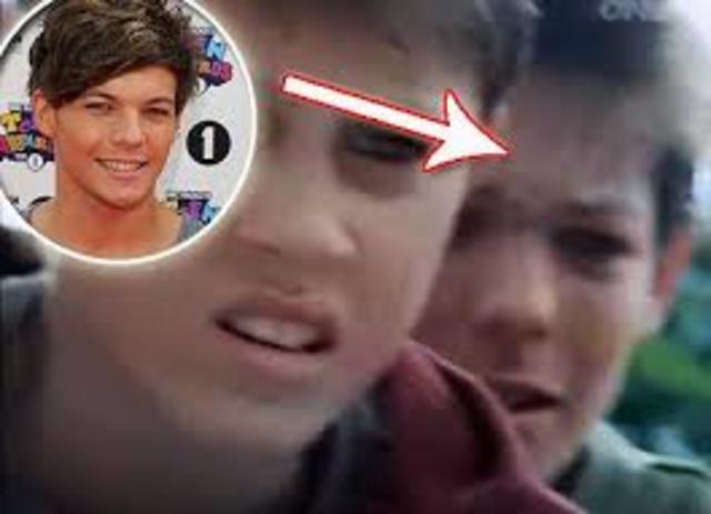 Louis y la actuación