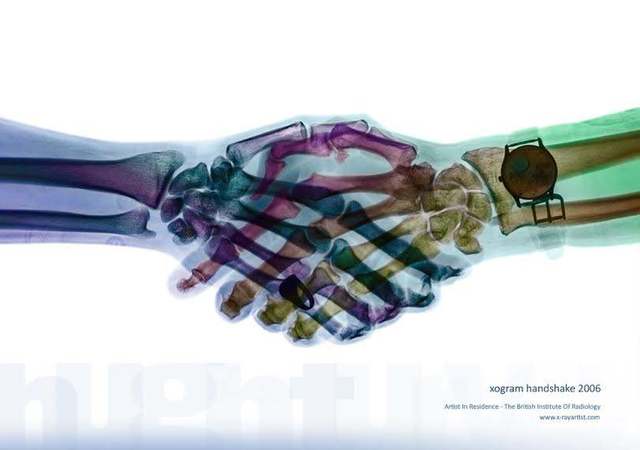 Incisivo Central Inferior