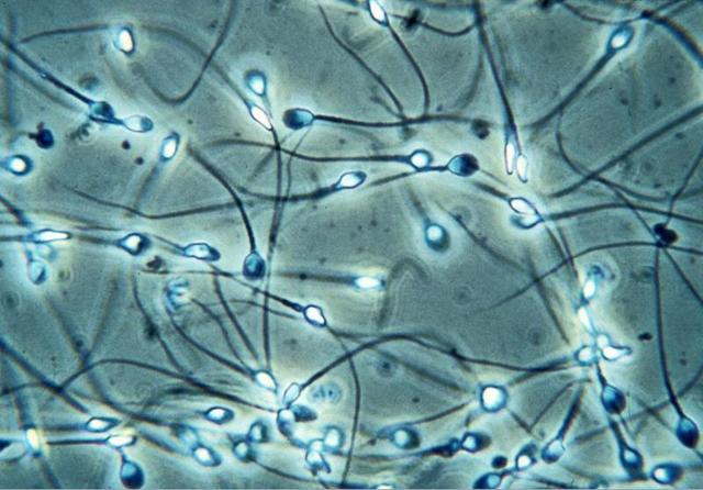 Anton van Leewenhoek's Third Discovery