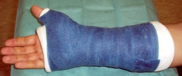 Me fracture la muñeca