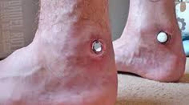 Ankle piercing