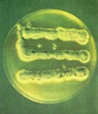 descubrimiento de la 2-	Penicilina.