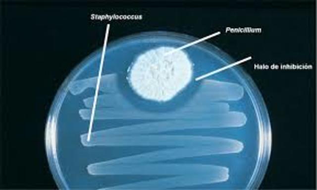 Descubrimiento de la pinicilina