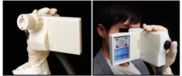 Portable Eye Scanner