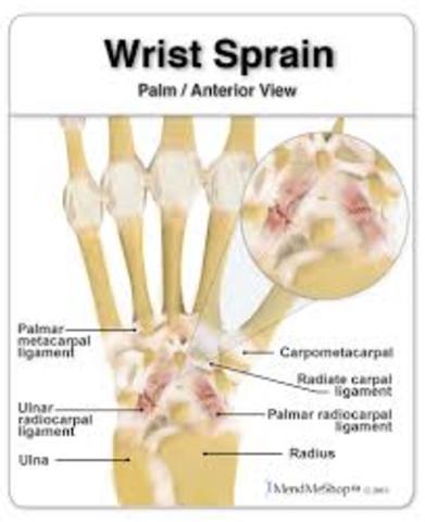 i injury my wrist 3 times