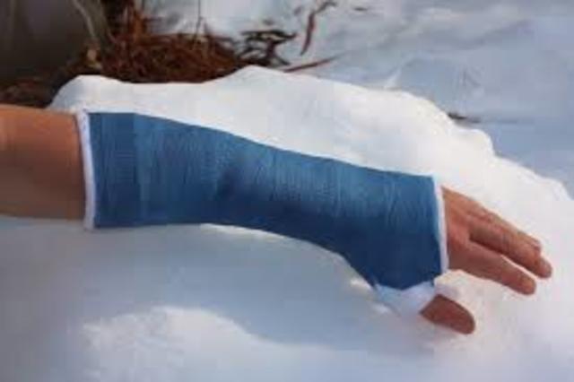 broke wrist in two places