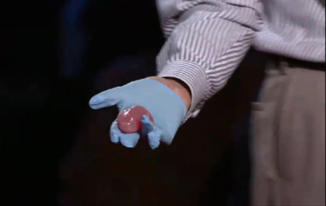 3D prinditud prinditud neer