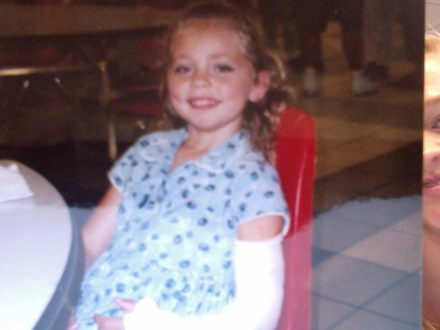 The first time I broke my arm