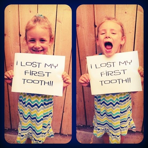 Lost her First Tooth