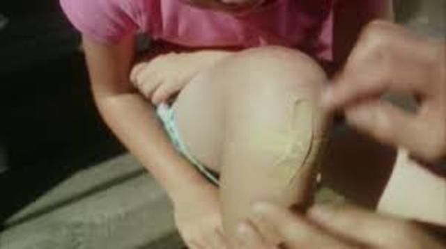 Scraped Knee