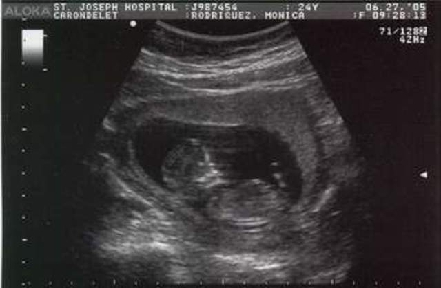 We find out we are pregnant!