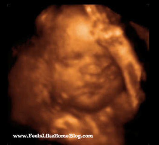 Our Ultrasound
