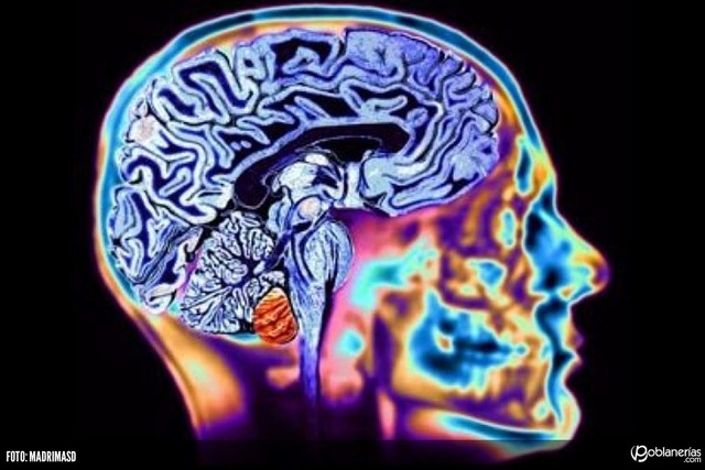 ''Laboratorios de EE.UU. y Francia aíslan el virus del HIV''