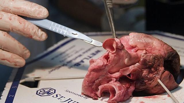 ''Avance de ingeniería genética''