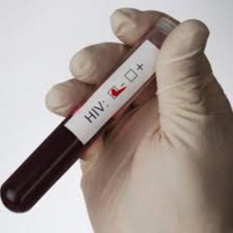 Lograron desarrollar un anticuerpo que identificaba a los infectados