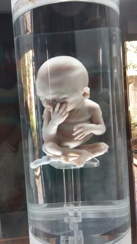 Fetos de 15 a 16 semanas