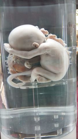 Fetos 17 a 20 semanas