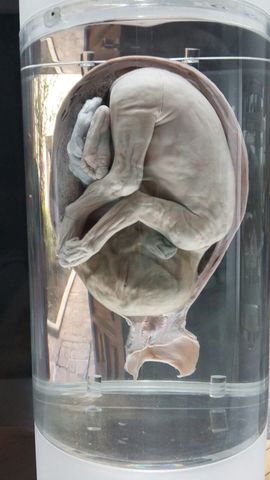 Fetos de 30 a 38 semnas