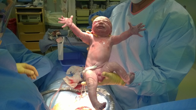 INFANT- Reflexes - physical