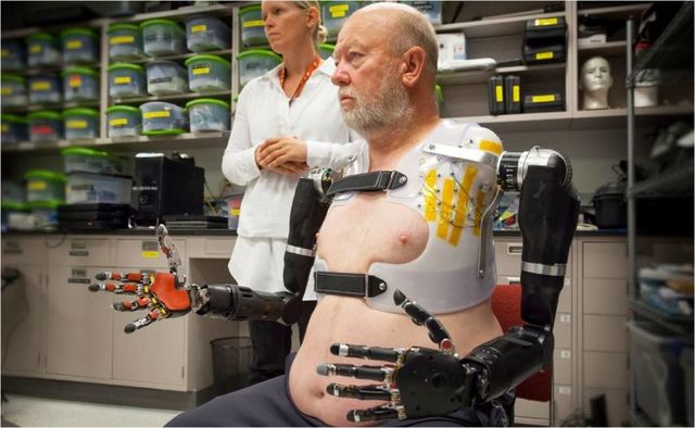 Primera prótesis robótica