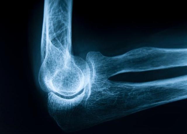 Descubrimiento de la máquina de Rayos X