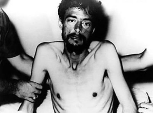 Gavrilo Princip died of malnutrition and disease