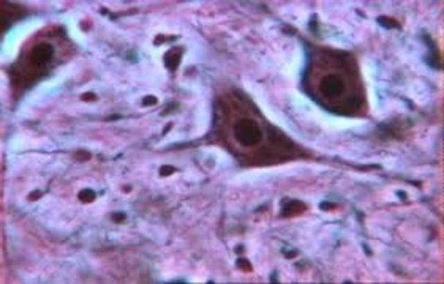 Tejido y Sistema Nervioso