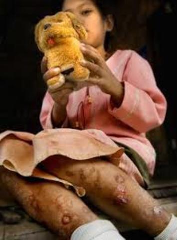 Argentina SOC: Aparecen las primeras personas infectadas por el síndrome inmunodeficiencia adquirida.