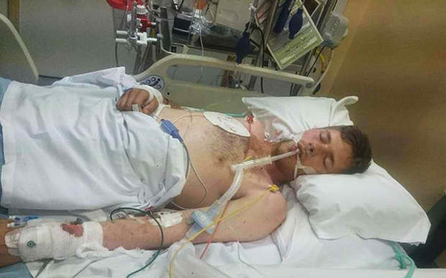 Jordan Blackburn, 20, in a coma after drug overdose