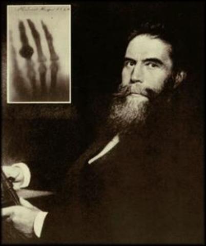 Rayos X. Wilhelm Roentgen