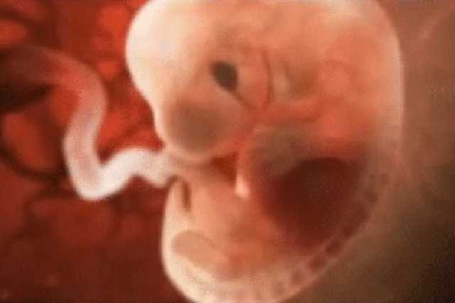 Embrion formacion final (semana tres)