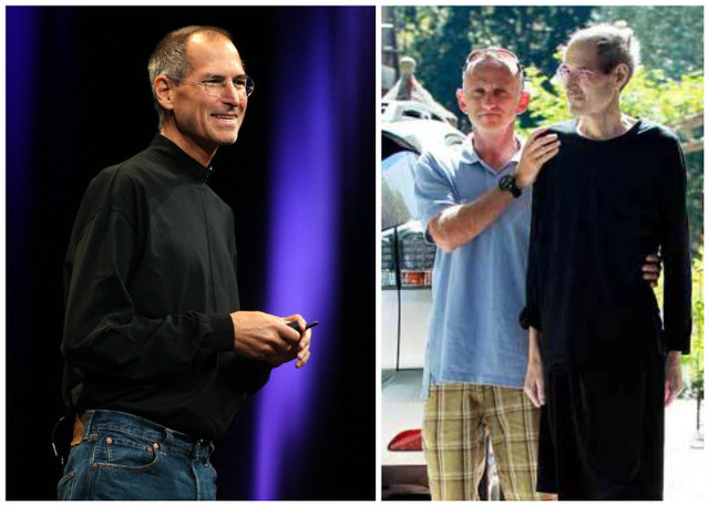 Jobs se somete a cirugía por el cáncer de páncreas.