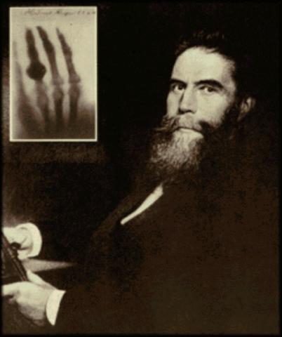 Rayos X. Wilhelm Roentgen