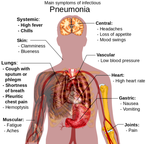 El diá cuando me enferme