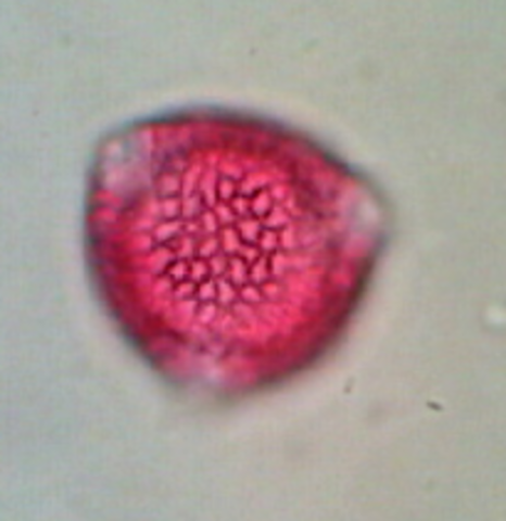 TP Nº 4: Confusiones Diagnósticas