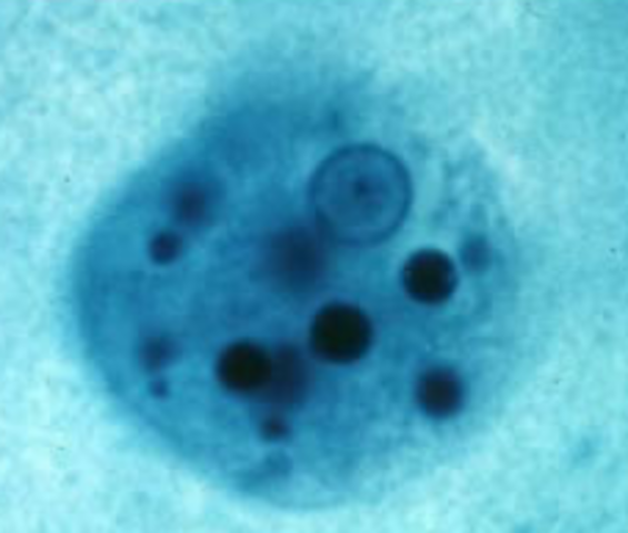 TP Nº 5: Protozoarios Intestinales