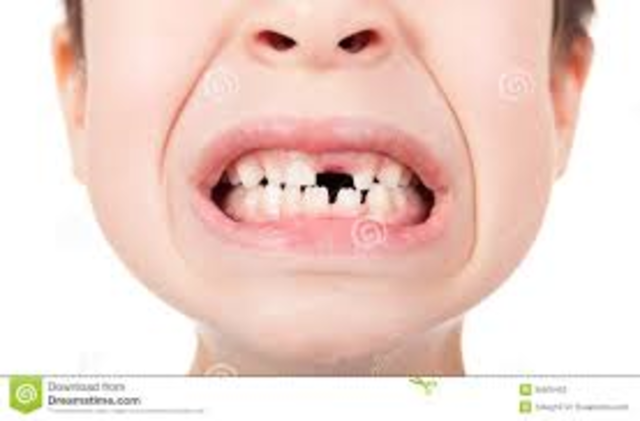 Yo perdí a mi primer diente