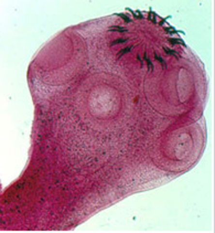 TP Nº 7: Enteroparásitos: Cestodes