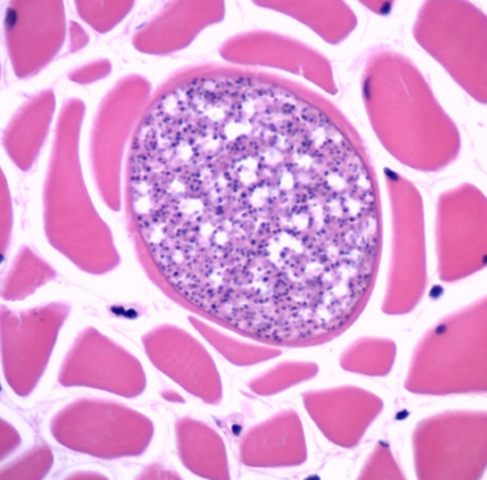 TP Nº 10: Esporozoarios Tisulares