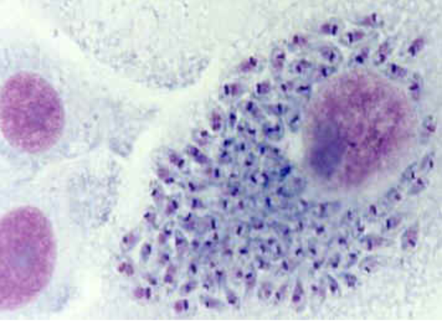 TP Nº 14: Hemoflagelados: Leishmanias