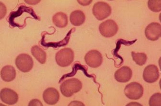 Descubrieron la primera enfermedad causada por TRYPANOSOMAS